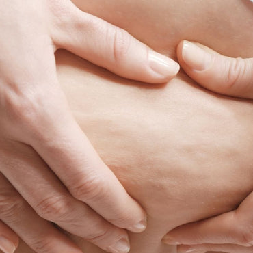 Warum ist es wichtig, überschüssige Flüssigkeit zu minimieren, um Cellulite zu bekämpfen?