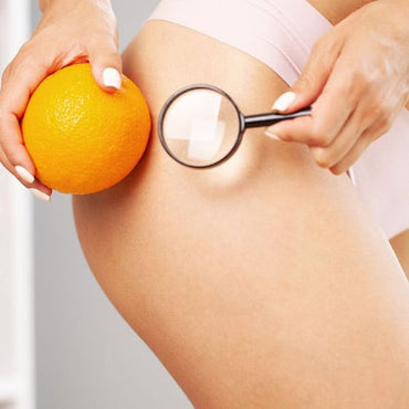 So löst du Wassereinlagerungen & Cellulite effektiv auf