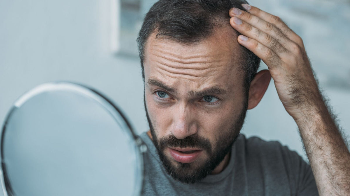 Alopecia masculina: causas, tipos y cómo prevenir la caída del cabello con Haar Forte Gold Pro Man